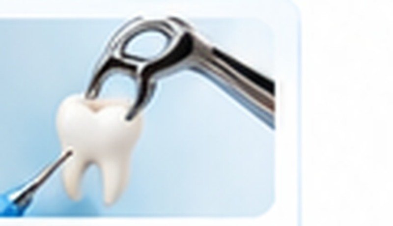 Extractions