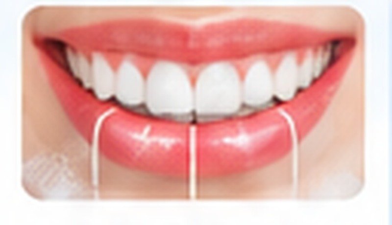 Teeth Reshaping